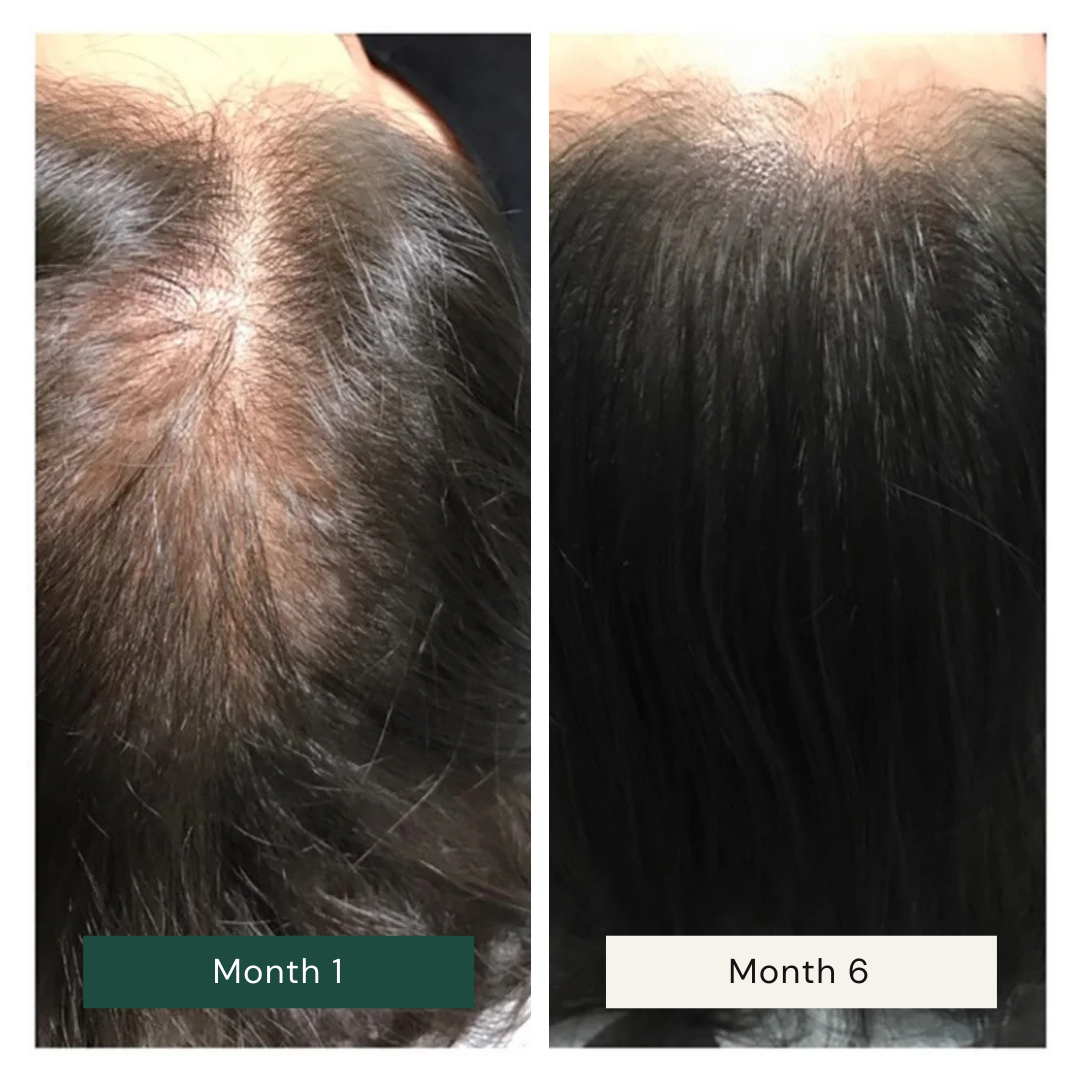 Strong Roots Scalp Oil (50ml)